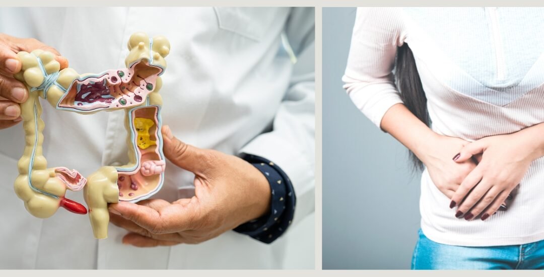 What Side Is Your Appendix On? How to Recognize Pain Before It Gets Serious