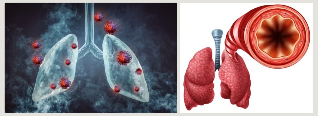 bronchitis symptoms and contagiousness