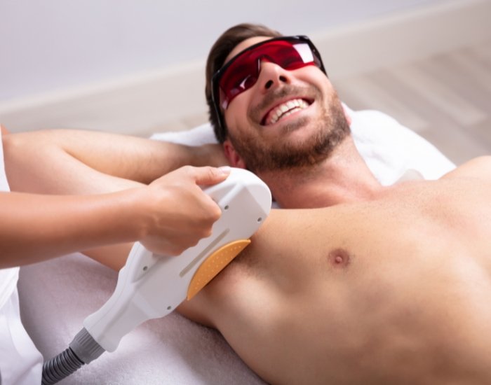 laser hair removal treatment