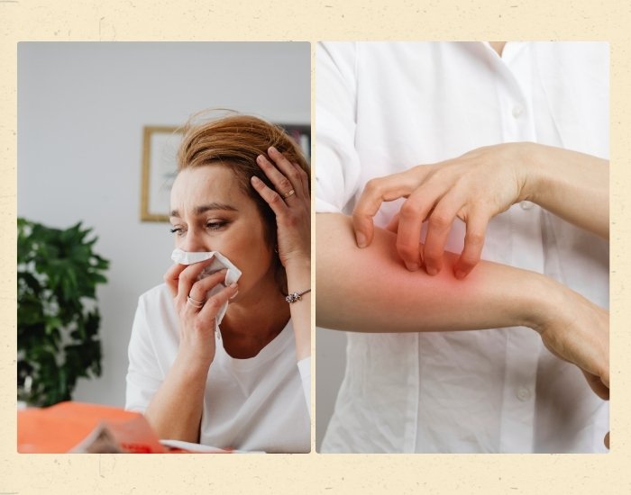 Common Cold and Allergies