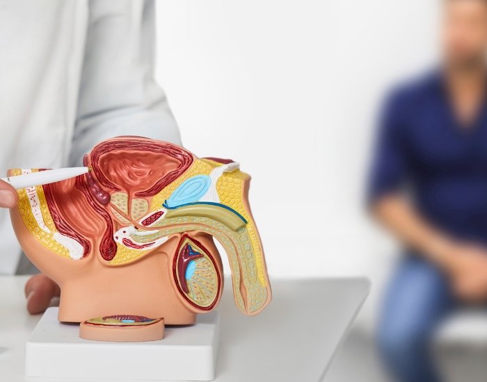 Signs and Symptoms Prostate Cancer