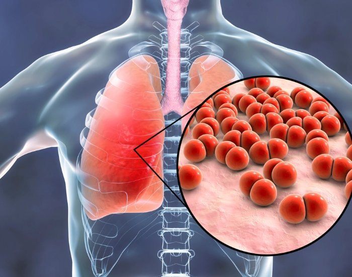 How Long Does Respiratory Infection Last